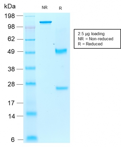 Data from SDS-PAGE analysis of Anti-PSAP antibody (Clone rAIF1/1909). Reducing lane (R) shows heavy and light chain fragments. NR lane shows intact antibody with expected MW of approximately 150 kDa. The data are consistent with a high purity, intact mAb.